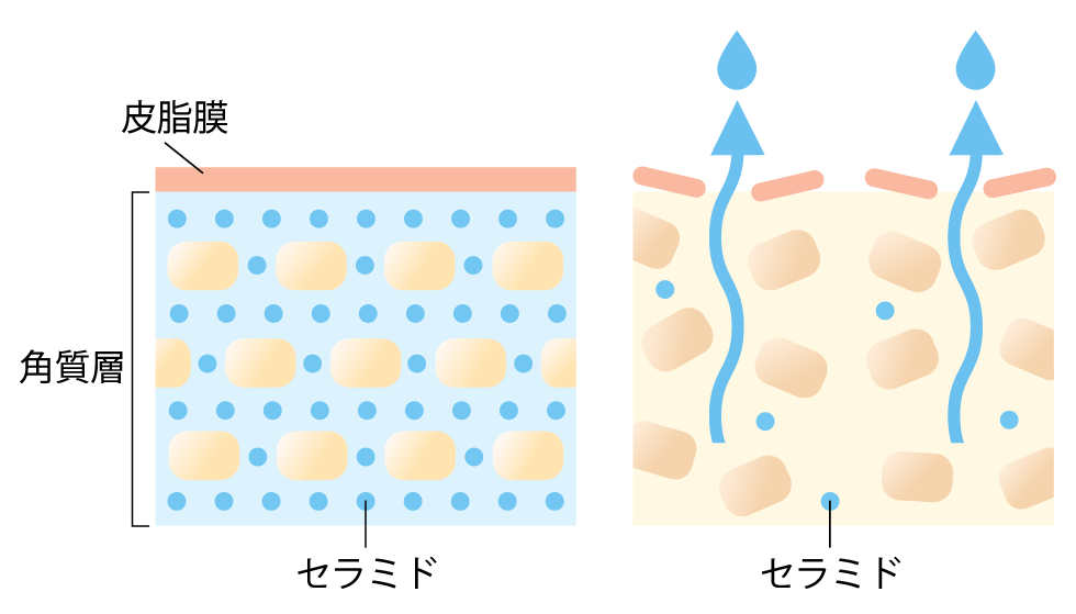 4種類のセラミド成分
