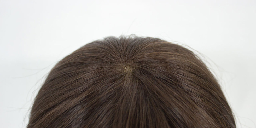 医療用ウィッグとは